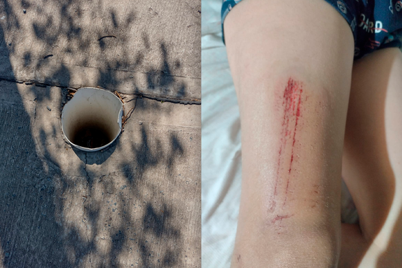 Paseo de los canastos: niño metió la pierna en un caño abierto y se lastimó
