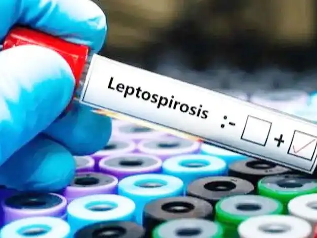 Preocupa el avance de la leptospirosis en Entre Ríos y crecen las alertas por la proliferación de roedores