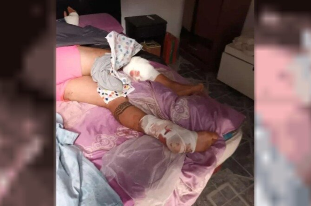 El joven herido