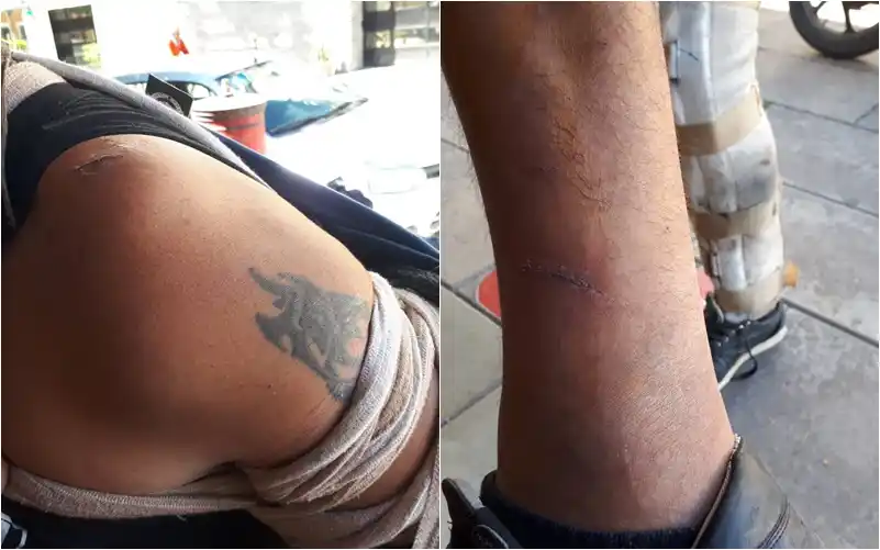 Mensajero denunció que, dos veces, perros salieron de una casa y lo atacaron y lesionaron