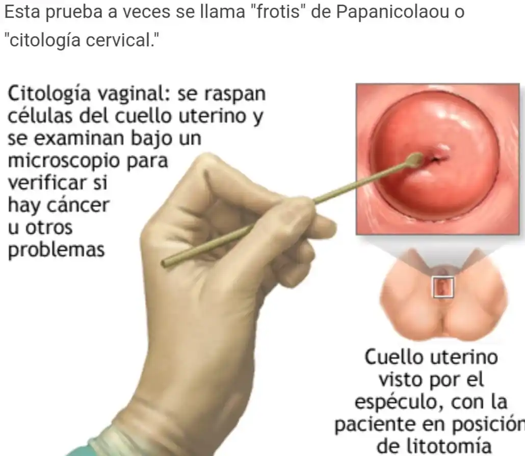 Exámenes ginecológicos