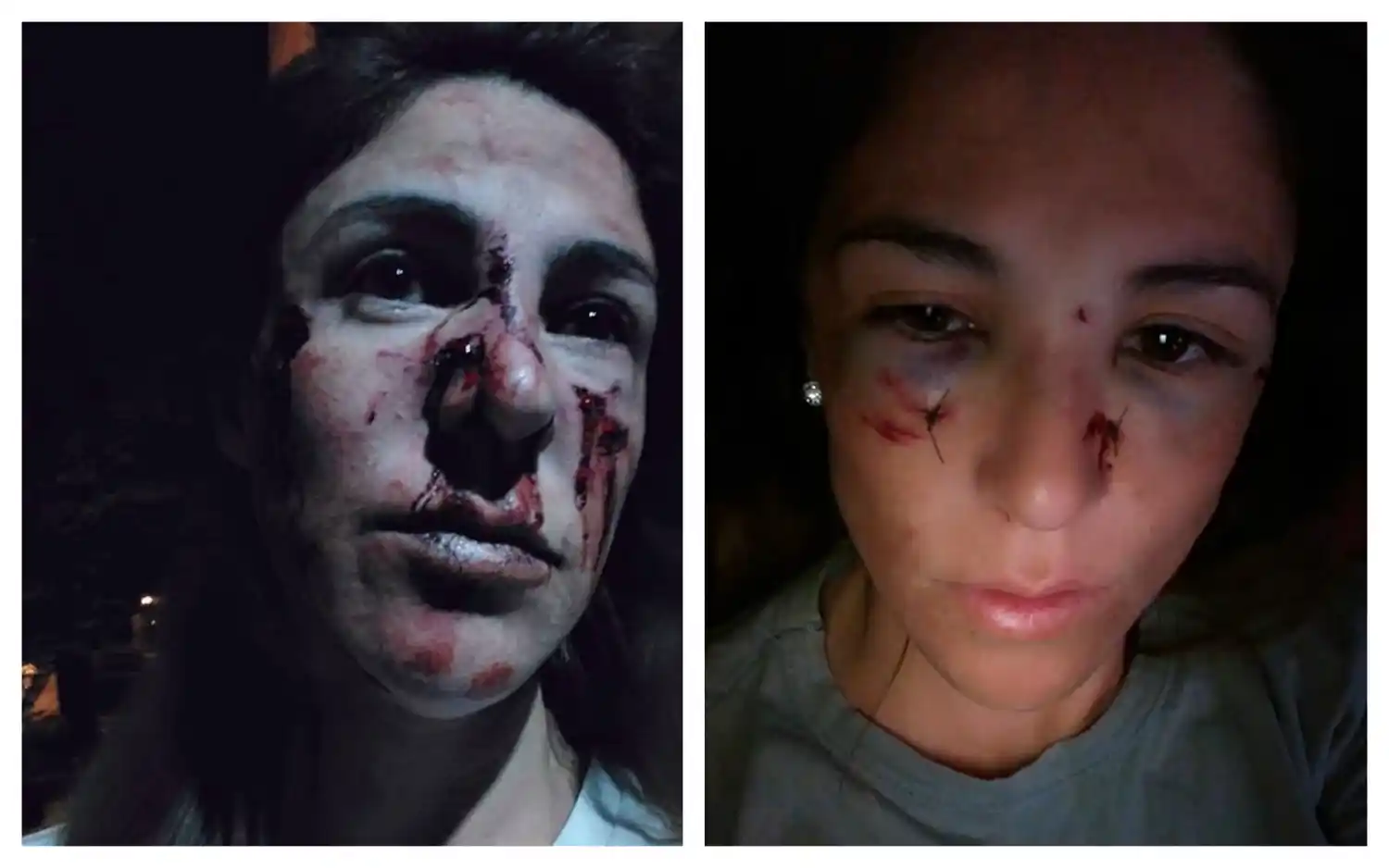 Una joven denunció un brutal ataque de su expareja a través de su cuenta de Facebook