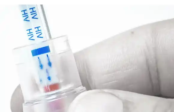 Las personas con VIH que desconocen su condición pasaron del 40% al 13% en 10 años