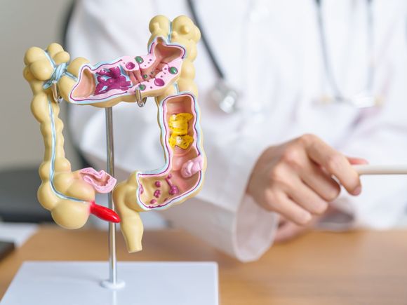 “El cáncer colorrectal es la segunda causa de muerte por cáncer en Argentina”