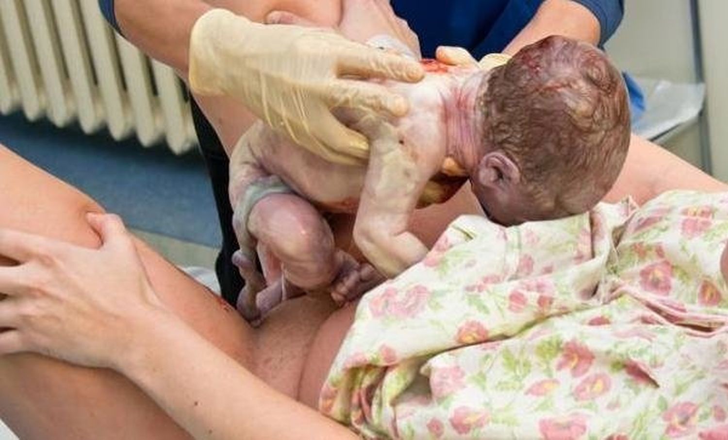La Organización Mundial de la Salud (OMS) recomienda en su informe de 2012: 