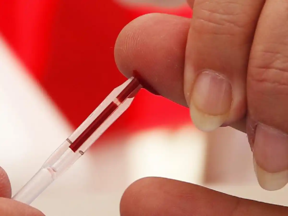 Más de 140 mil personas viven con VIH Sida en la Argentina y no descendió la mortalidad