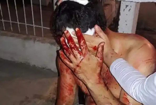 Habrían identificado a los agresores del otro hombre golpeado con un hierro