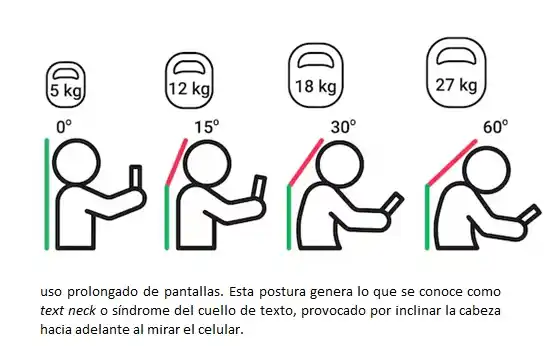 Síndrome de cuello de texto