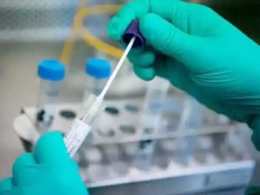 Covid-19: hubo un aumento de casos en la provincia