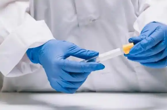 Tres personas fallecieron por coronavirus en la Argentina y las víctimas ya son 82