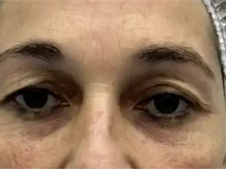 Embellecimiento de la mirada