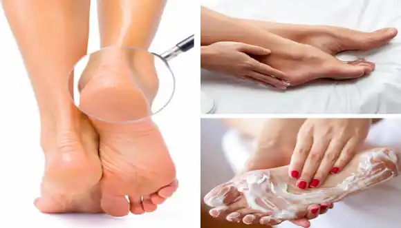 DILE ADIÓS A LOS PIES RESECOS con este ungüento casero – VIDEO