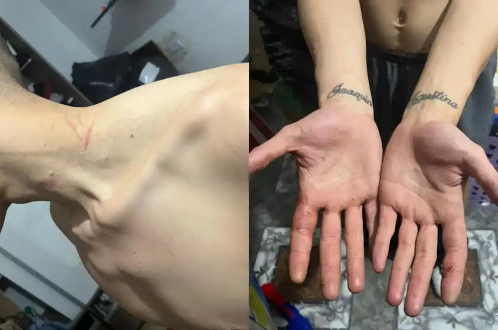 hermano de Ayton preso 2