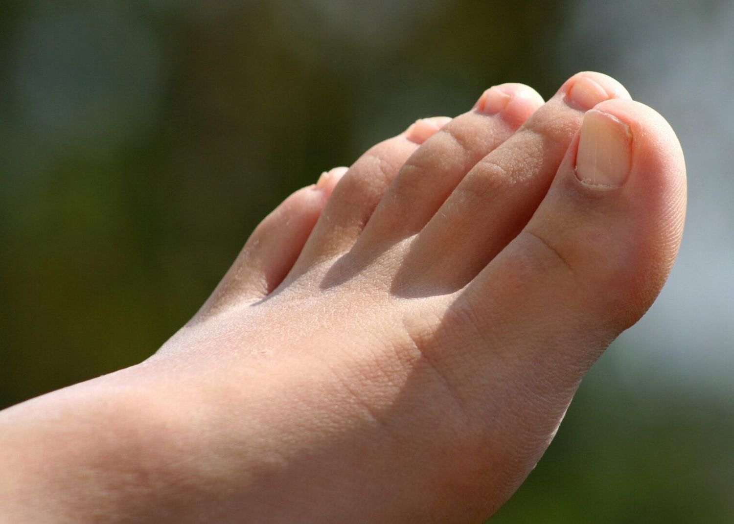 ¿Sufres de hongos en los pies? Estos remedios caseros te pueden interesar