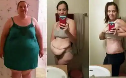 Bajó 100 kilos pero no quedó conforme: "Me veo como una vela derretida"