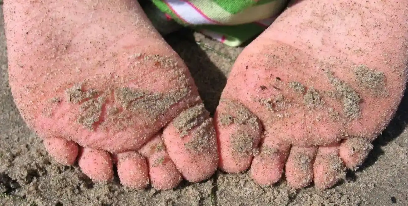 Entre estas advertencias se destaca la del llamado “bicho de pé”