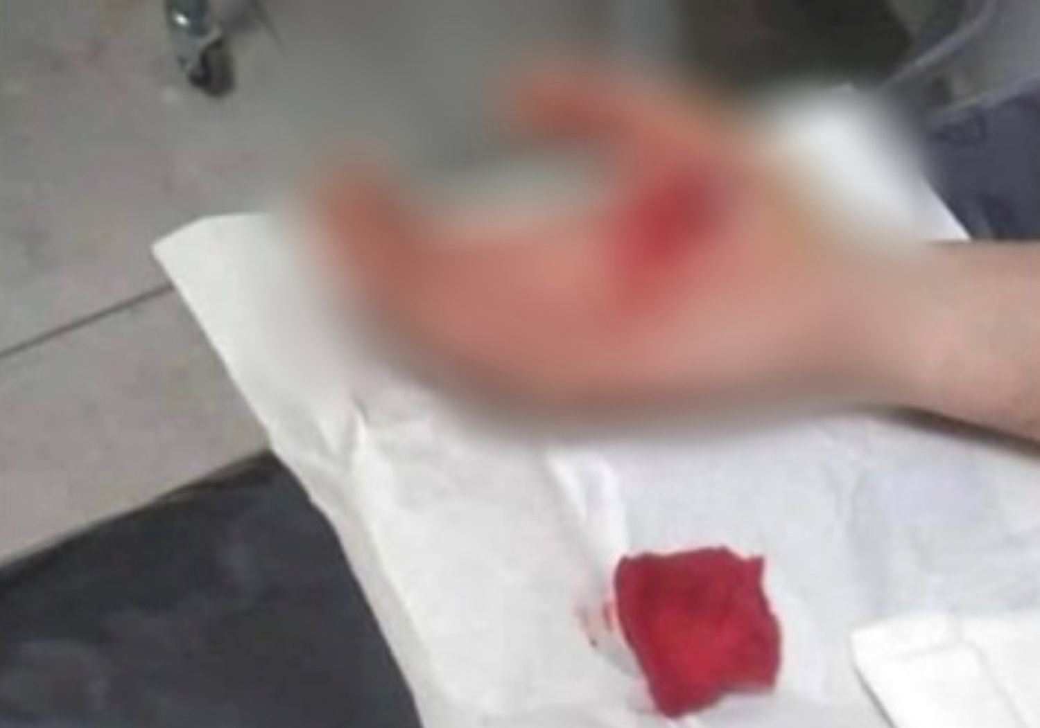 Cuatro puntos de sutura para un recolector que se cortó la mano con una botella rota
