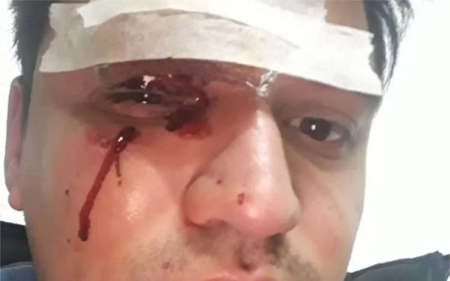 Video: Paro en la línea de colectivos 203 tras la salvaje agresión a un chofer en San Fernando