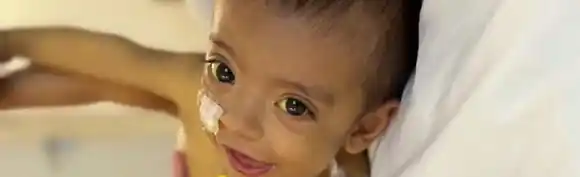 Un bebé de nueve meses sufre de una extraña enfermedad y está a la espera de un nuevo hígado que lo ayude