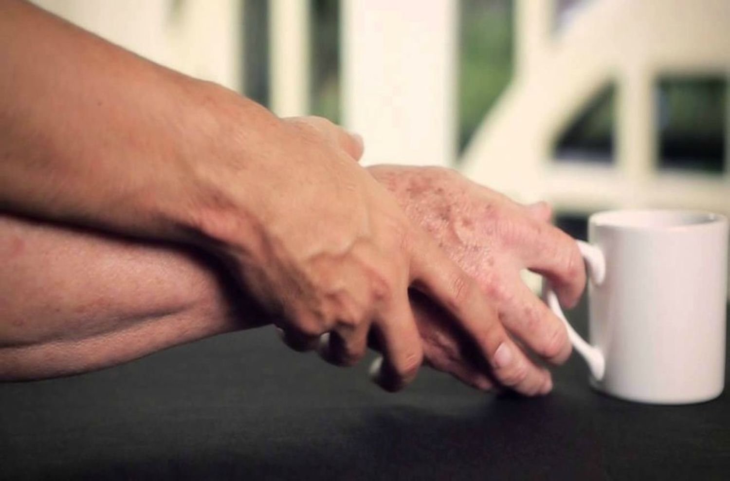 Día Mundial del Parkinson: aseguran que “están aumentando” los casos