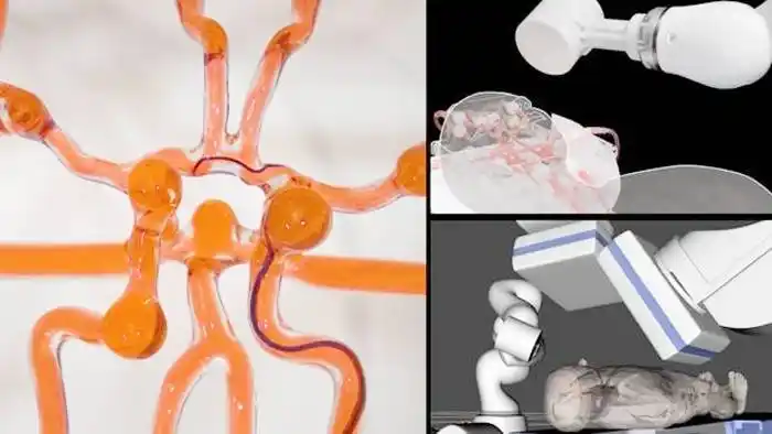 Desarrollan un joystick que podría permitir a los cirujanos operar rápido y a distancia un ictus