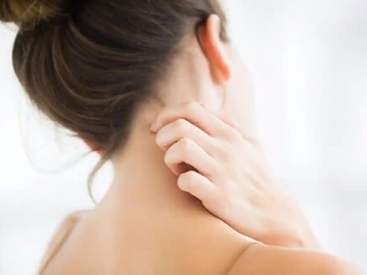 Dermatitis atópica: una nueva vida es posible   