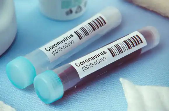 Más de 20 millones de casos de coronavirus en todo el mundo