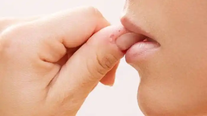 Morderse las uñas: esto pasa en tu cuerpo cada vez que lo haces