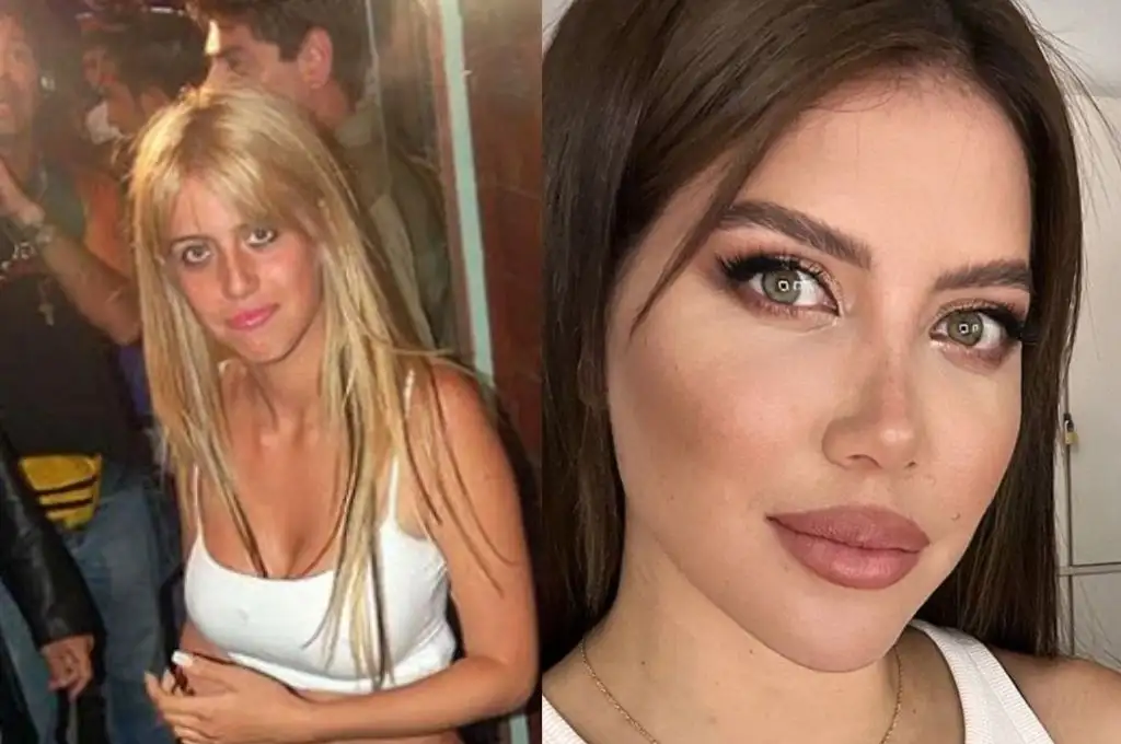 Estas son todas las cirugías estéticas que se hizo Wanda Nara para ser famosa