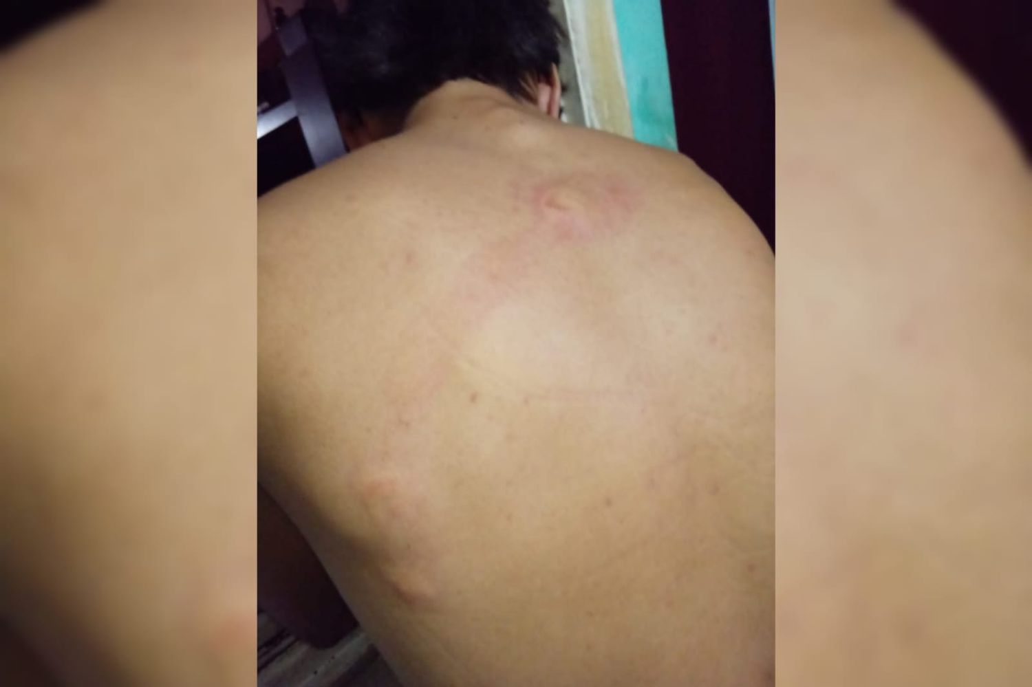 Una pandilla de niños de 9 a 15 años de Gualeguaychú roba y agrede a vecinos con cuchillos y látigos