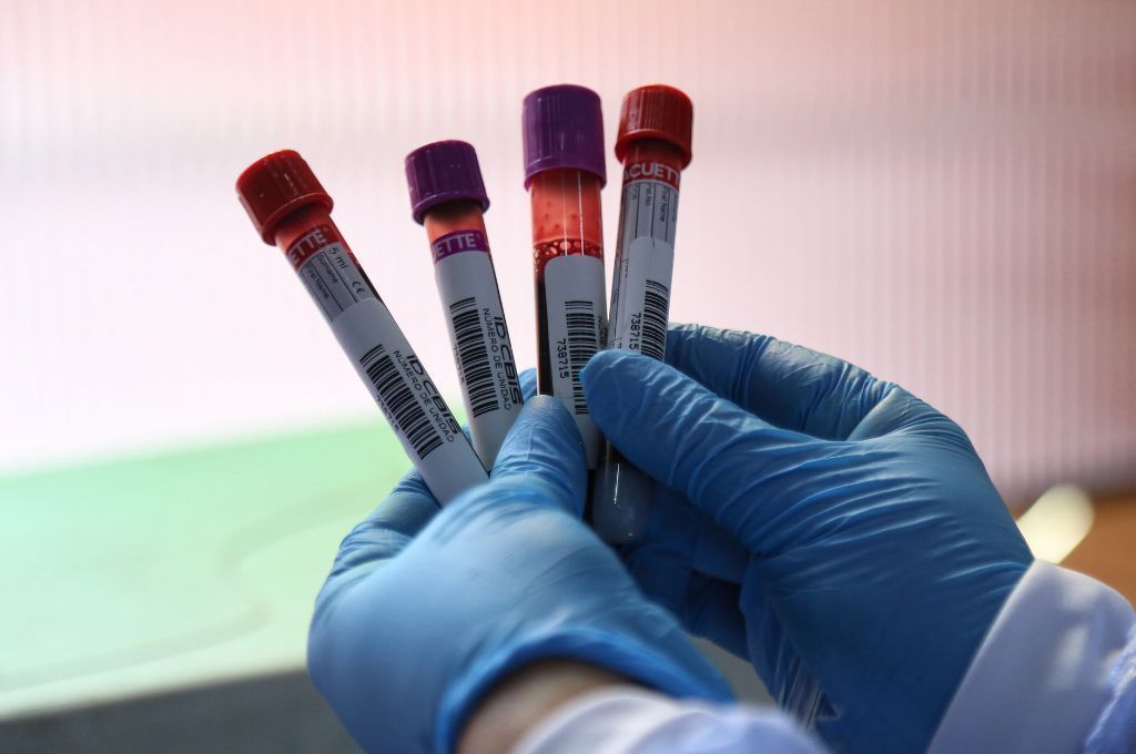 Un estudio científico revela que la sangre de ciclistas de élite podría ayudar a prevenir enfermedades