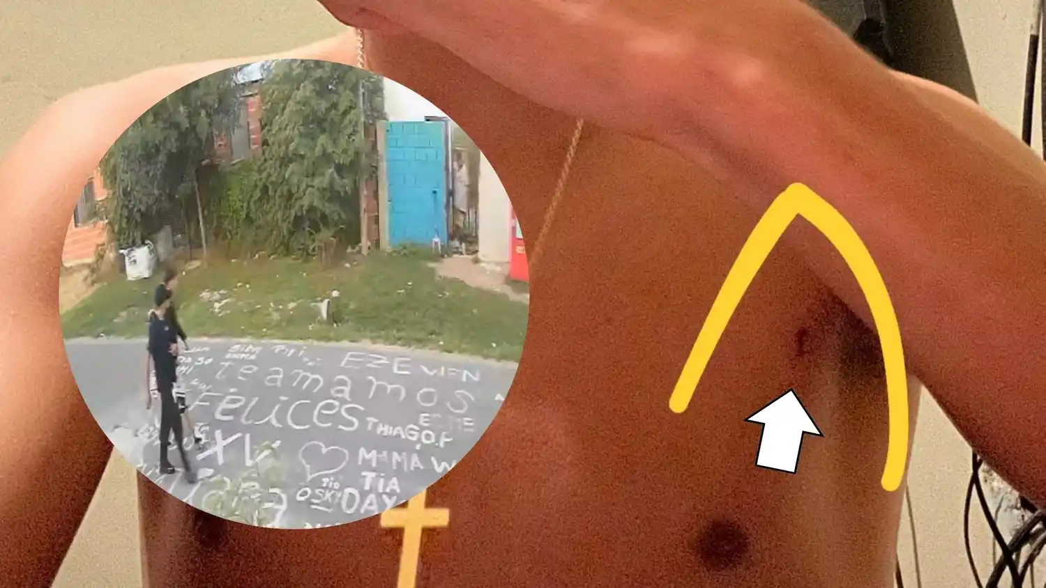 El joven presentó una herida en una axila por el roce de un proyectil. Algunos ataques fueron registrados por cámaras de seguridad.
