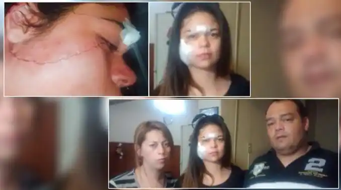 Otra adolescente fue desfigurada por "cheta y linda" en Rosario