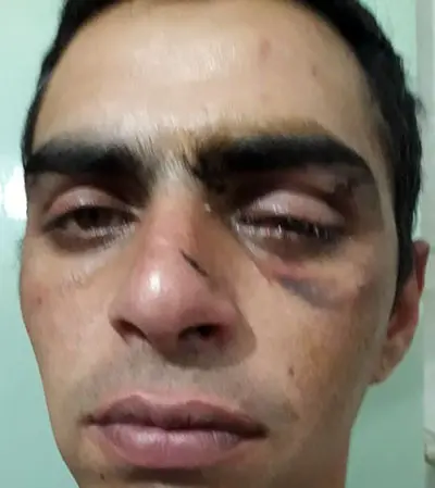 “A mi hijo lo agredieron con ensañamiento y sufrió lesiones graves”, dijo Elsa González