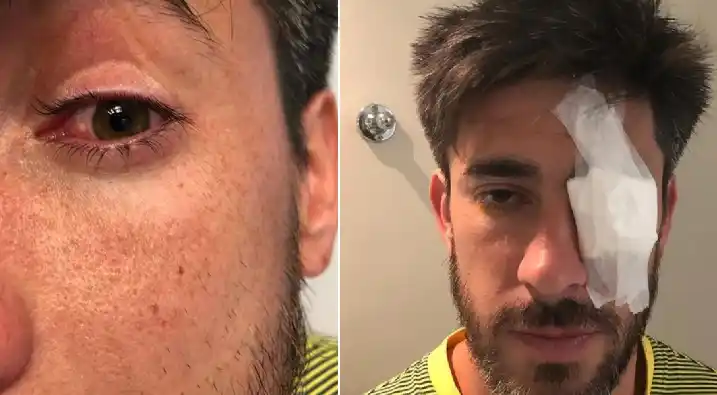 El parte, úlcera de córnea: así quedó Pablo Pérez después de haber sido atendido en un hospital