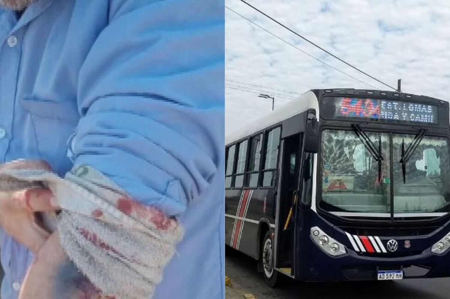 El chofer recibió un disparo en el codo del brazo izquierdo.