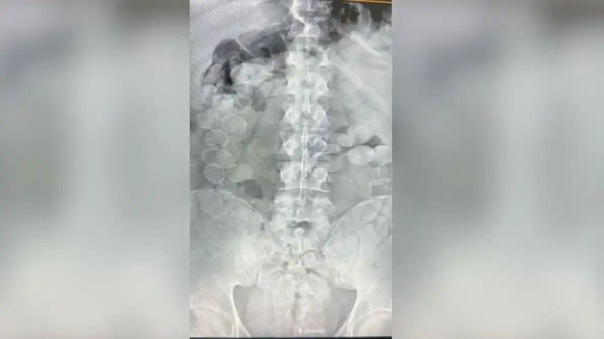 dos personas fueron detenidas en un control en la Ruta Nacional 34 con más de 160 cápsulas de cocaína dentro de sus cuerpos - 1