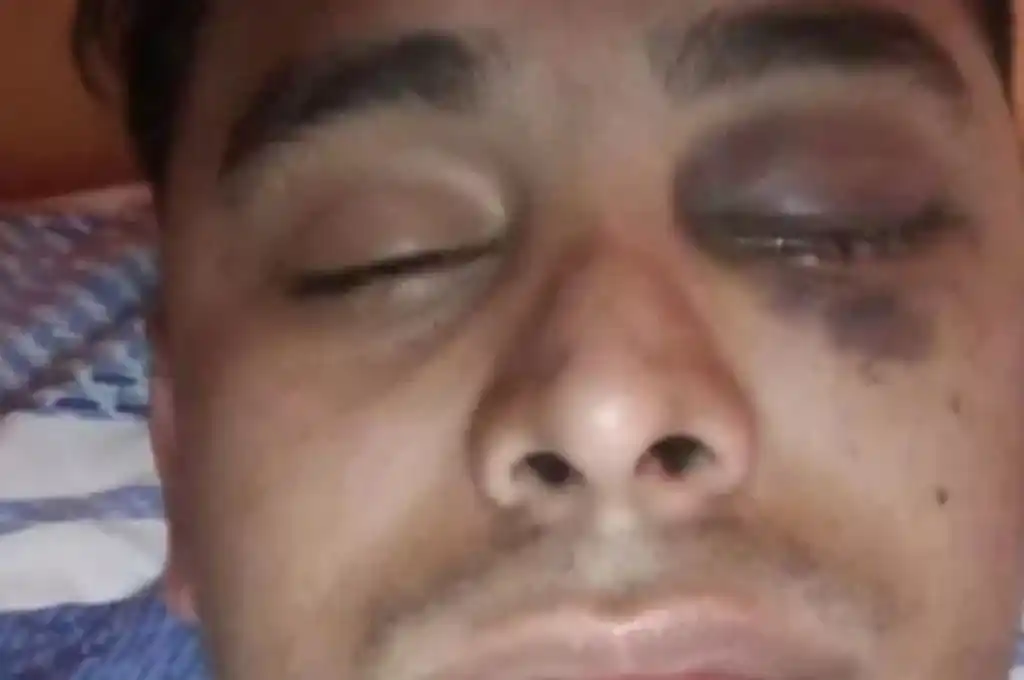 Federico Zárate, el joven agredido, recibió 30 puntos de sutura