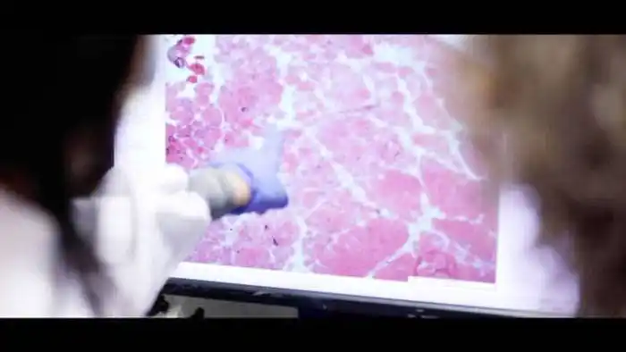 Cinco de cada 100 pacientes con covid  desarrollará algún problema de corazón