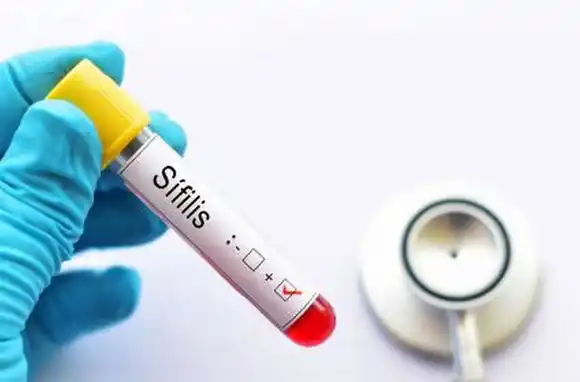 Alarmante aumento de casos de sífilis entre jóvenes: "Hay una falta total de conciencia"