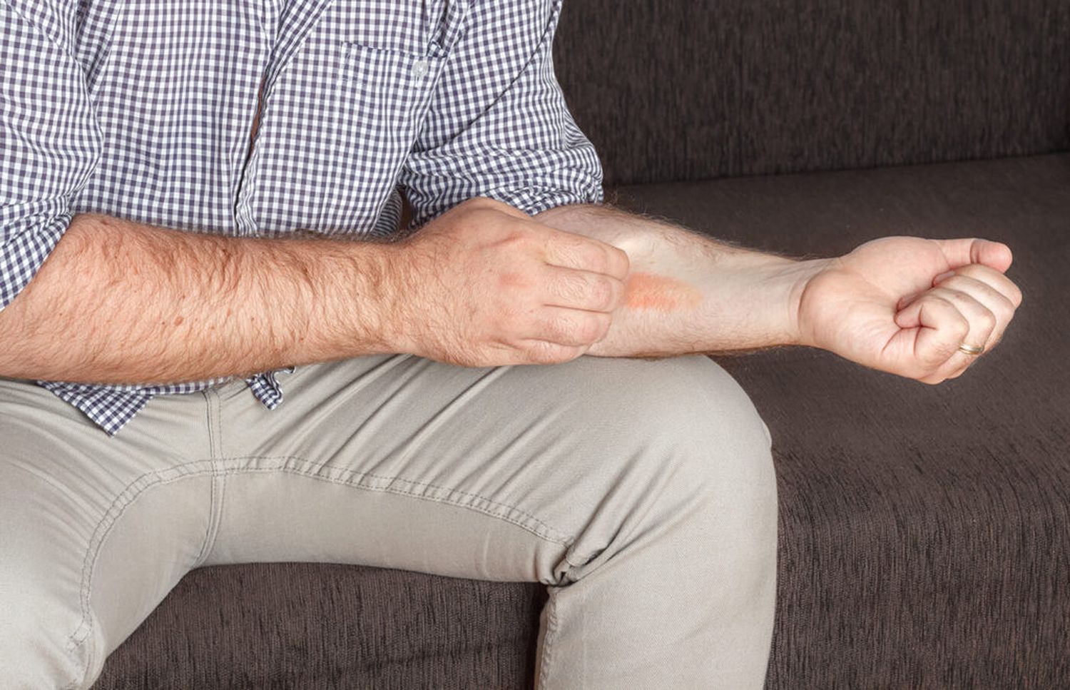 Hoy es el Día de la Concientización sobre la Dermatitis Atópica