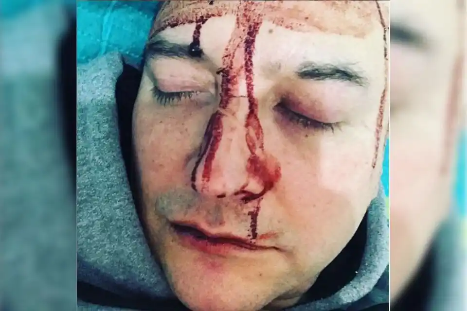 Leo García sufrió ataque homofóbico: “Esto no es un maquillaje”, dijo desde General Rodríguez