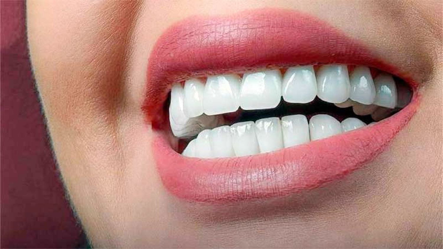 Turismo dental en Turquía: un Radiante Destino de Sonrisas