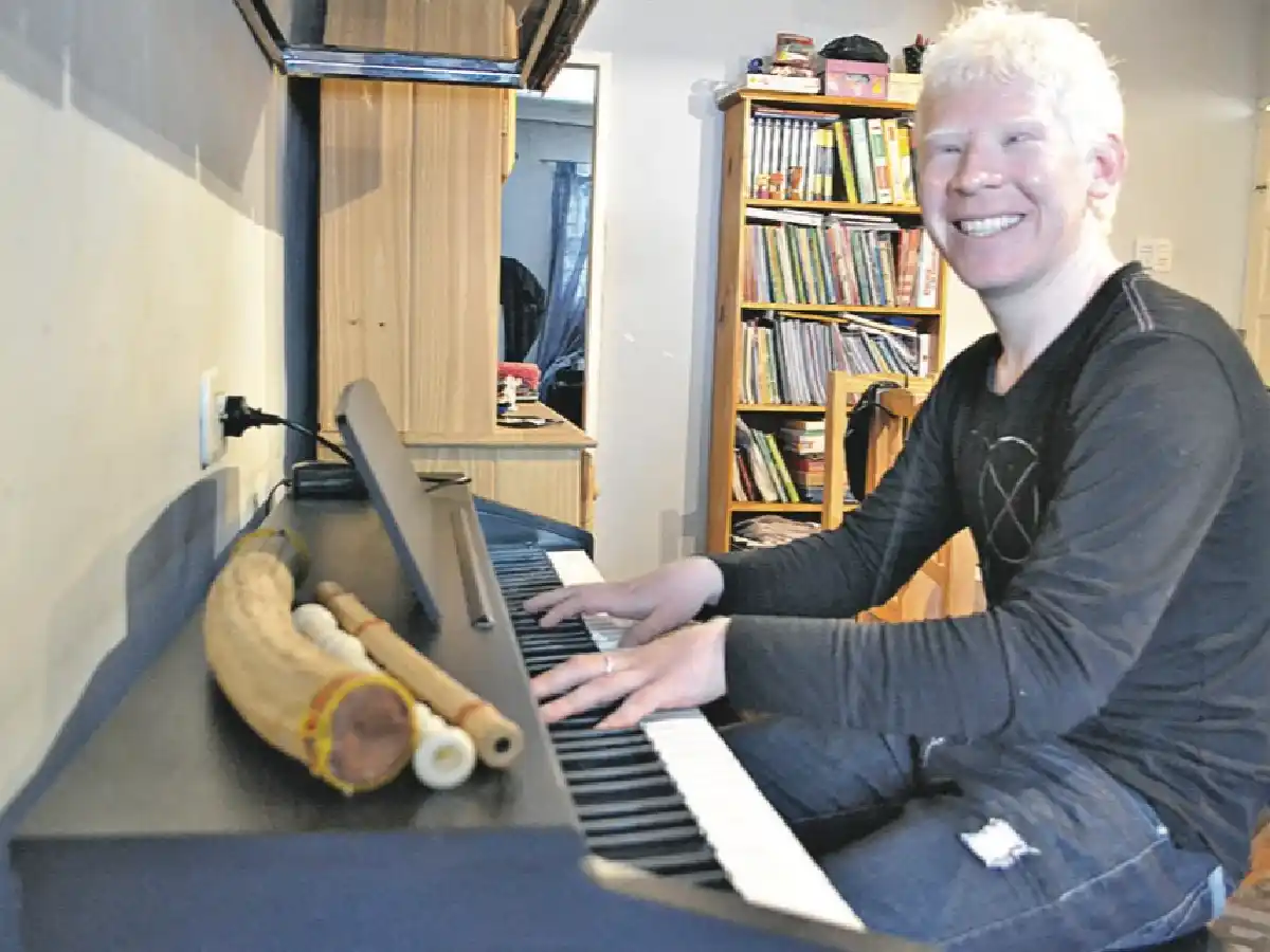 Cómo es la vida de un albino: el día a día de Agustín