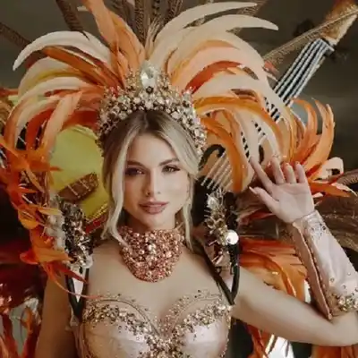 La entrerriana Aldana Masset, representante argentina en Miss Universo, reveló que convive con alopecia