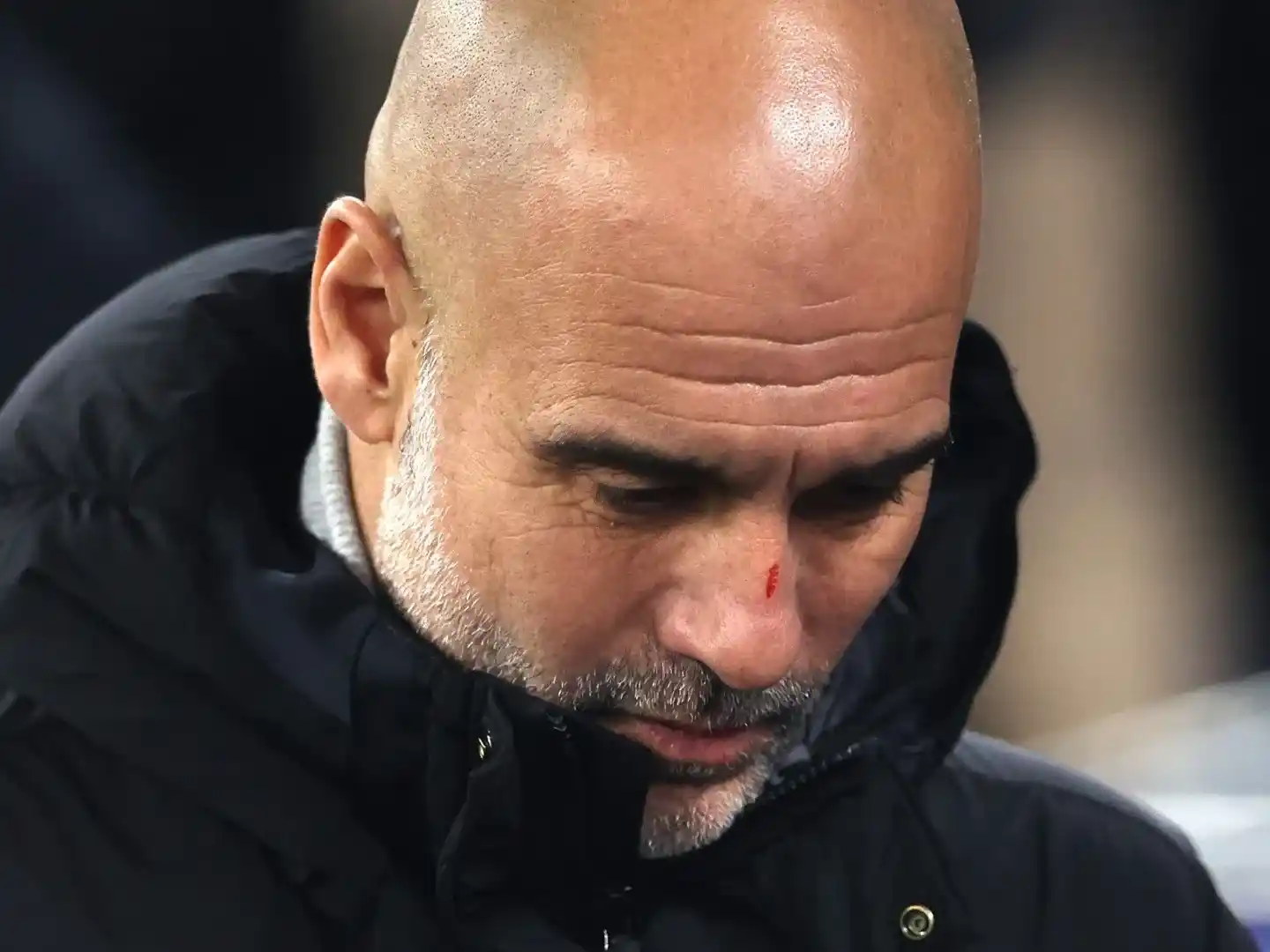 Pep Guardiola. Lastimado por sus propias uñas.