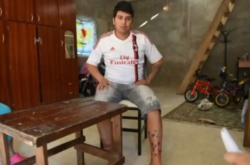 Acribillaron a Ema Pimpi Sandoval, el acusado de balear la casa de Bonfatti