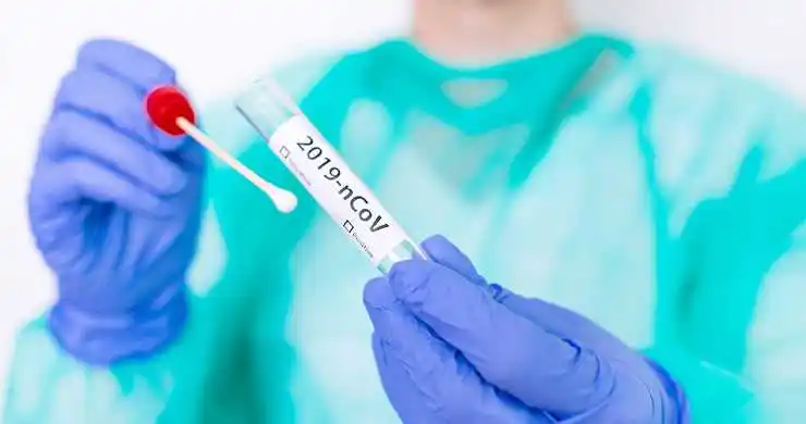 En Argentina se reportaron ayer 88.352 nuevos casos y 51 fallecidos por coronavirus