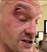 Postergaron el combate entre Tyson Fury y Oleksandr Usyk
