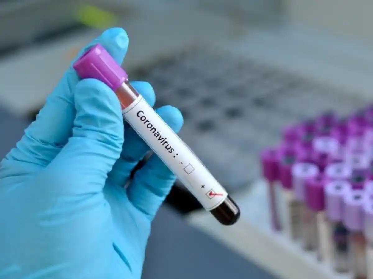 Segundo caso de coronavirus en la ciudad de Selva